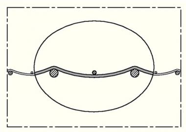 Absaug- u.Geblseschlauch - 4 MT  SIL 391 ONE ID 127mm L.4m Rl.NORRES