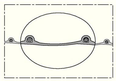 Absaug- u.Geblseschlauch - 10 MT  TIMBERDUC PUR 532 AS ID 150mm L.10m NORRES